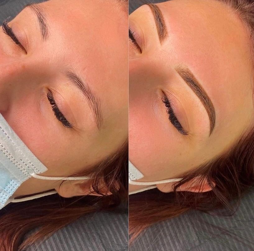 Brow Transformation