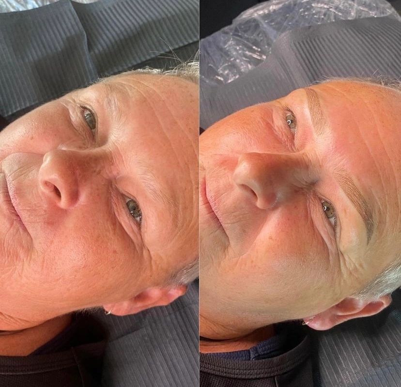 Eyeliner Enhancement