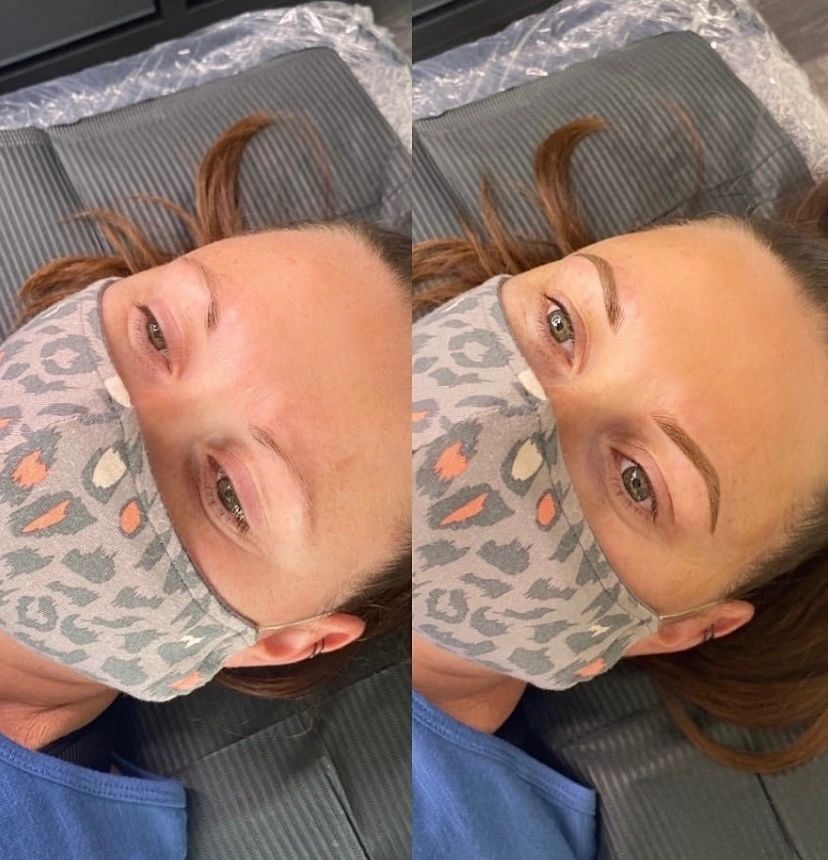 Brow Transformation