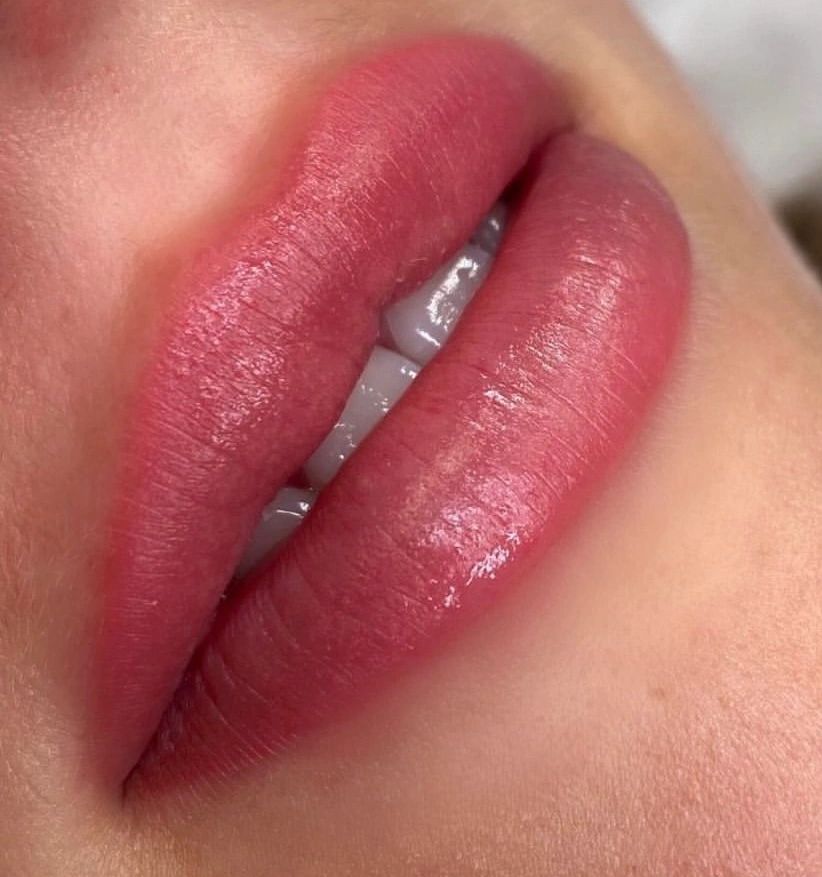 Lip Blush, Healed